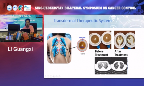 李光熙教授攜TTS?科技參加中國——烏茲別克斯坦癌癥防治雙邊研討會
